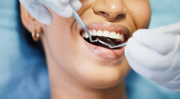 Best Knocked-Out Tooth Emergency  in Donaldsonville, LA