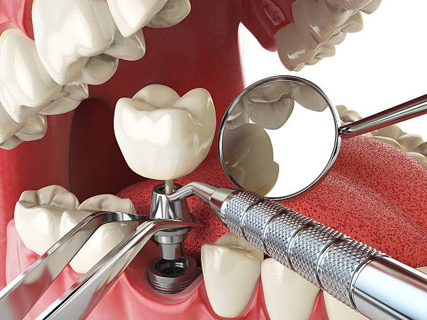 24-Hour Dental Clinic Near Me in LA